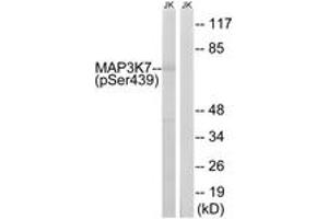 Western blot analysis of extracts from Jurkat cells treated with PMA 125ng/ml 30', using MAP3K7 (Phospho-Ser439) Antibody.