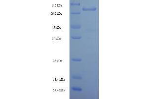 Leucine Rich Repeat Neuronal 1 (LRRN1) (AA 26-631) protein (His-SUMO Tag)