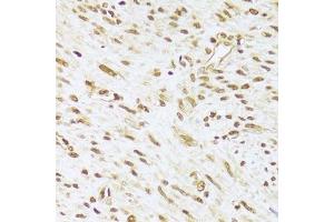 Immunohistochemistry of paraffin-embedded human leiomyoma of uterus using ANP32A Antibody.
