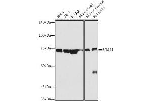 Western blot analysis of extracts of various cell lines, using RG antibody (ABIN6127968, ABIN6146621, ABIN6220915 and ABIN6220916) at 1:500 dilution.
