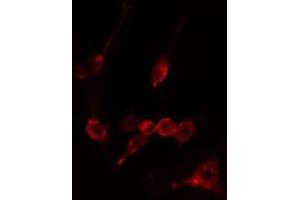 ABIN6274937 staining LOVO cells by IF/ICC. (CAPN10 anticorps  (N-Term))
