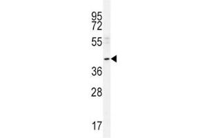 NEU2 antibody western blot analysis in A549 lysate.