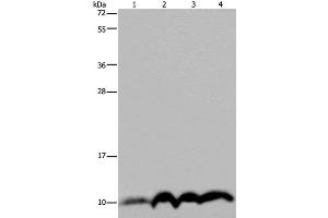 Western Blot analysis of SKOV3 cell and Human fetal liver tissue, Human fetal brain tissue and Hela cell using NDUFA4 Polyclonal Antibody at dilution of 1:300 (NDUFA4 anticorps)