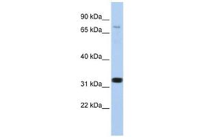 CACNB2 antibody used at 1 ug/ml to detect target protein.
