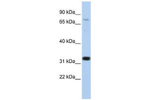 CACNB2 antibody used at 1 ug/ml to detect target protein. (CACNB2 anticorps  (N-Term))