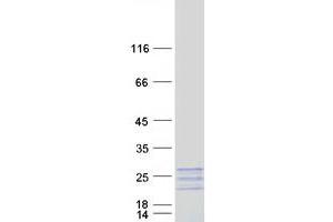 Validation with Western Blot