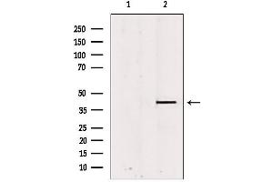 Western blot analysis of extracts from rat brain, using PSAT1 antibody.
