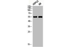 Western Blot analysis of HEPG2 KB using Phospho-Akt1 (S246) Polyclonal Antibody (AKT1 anticorps  (pSer246))