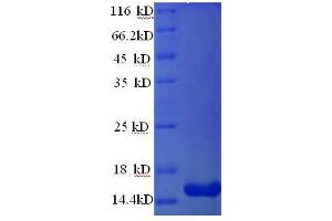 SDS-PAGE (SDS) image for Resistin (RETN) (AA 19-109) protein (His tag) (ABIN5710246)