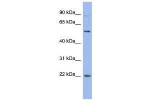 WB Suggested Anti-HMGB4 Antibody Titration:  0. (HMGB4 anticorps  (N-Term))