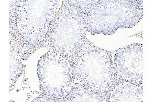 ABIN7094735 and ABIN7098786 at 1/100 staining Rat testis tissue by IHC-P. (POLQ anticorps  (Internal Region))