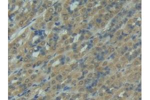 Detection of FASL in Rat Intestine Tissue using Polyclonal Antibody to Factor Related Apoptosis Ligand (FASL)