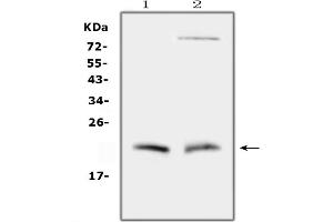anti-Cytoglobin (CYGB) (AA 1-190) antibody