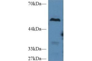 Detection of CPB2 in Mouse Liver lysate using Polyclonal Antibody to Carboxypeptidase B2 (CPB2)