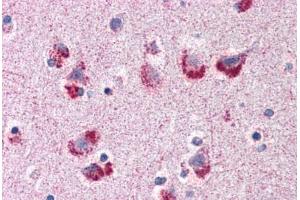 Human Brain, Cortex (formalin-fixed, paraffin-embedded) stained with MAG antibody ABIN307172 at 5 ug/ml followed by biotinylated goat anti-rabbit IgG secondary antibody ABIN481713, alkaline phosphatase-streptavidin and chromogen.