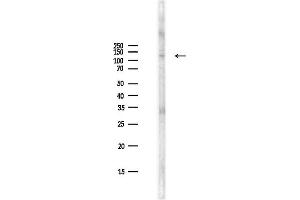 Western blot analysis of lysates from PC12 cells(LPS,4h treatment), using NEDD4L Antibody at 1/1000 dilution.