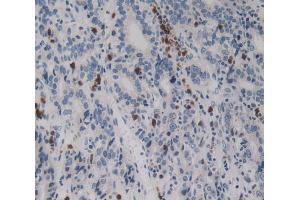 Used in DAB staining on fromalin fixed paraffin- embedded stomach cancer tissue (Netrin 4 anticorps  (AA 349-592))