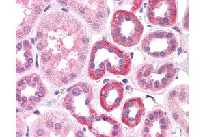 Immunohistochemistry (IHC) image for anti-HNF1 Homeobox A (HNF1A) (N-Term) antibody (ABIN2784536)