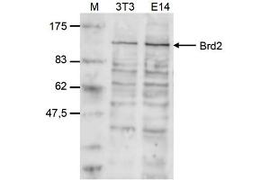 Western Blot of anti-Brd2 antibody Western Blot results of Rabbit anti-Brd2 antibody.