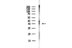 anti-Protein Kinase, AMP-Activated, beta 2 Non-Catalytic Subunit (PRKAB2) (N-Term) antibody