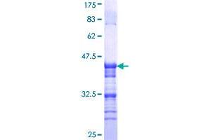Image no. 1 for Transient Receptor Potential Cation Channel, Subfamily V, Member 1 (TRPV1) (AA 21-124) protein (GST tag) (ABIN1323832)