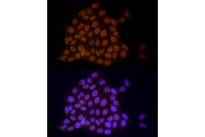 Immunofluorescence analysis of HeLa cells using TCE Rabbit mAb (ABIN7270877) at dilution of 1:25 (40x lens). (TCEA1 anticorps)