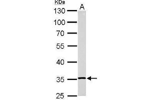 WB Image RPL5 antibody detects RPL5 protein by Western blot analysis.