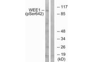 Western blot analysis of extracts from 293 cells treated with etoposide 25uM 60', using WEE1 (Phospho-Ser642) Antibody. (WEE1 anticorps  (pSer642))
