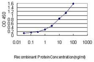 Detection limit for recombinant GST tagged MAD2L1 is approximately 0.