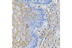 Immunohistochemistry of paraffin-embedded human esophagus using COL1A1 antibody. (COL1A1 anticorps)