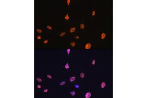 Immunofluorescence analysis of C6 cells using Cyclin E1 Rabbit mAb (ABIN7266564) at dilution of 1:100 (40x lens).