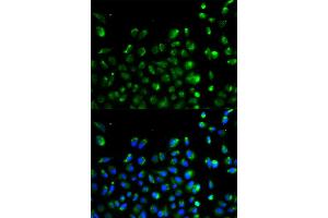 Immunofluorescence analysis of A549 cells using ATG13 antibody (ABIN5970264). (ATG13 anticorps)