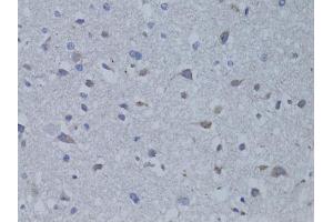 Immunohistochemistry of paraffin-embedded rat brain using BDNF antibody. (BDNF anticorps)