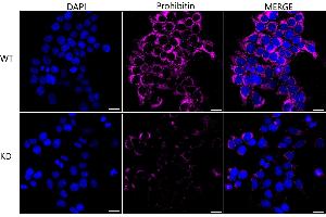 Immunocytochemical staining of HeLa cells using Prohibitin antibody (ABIN7799910), 1:1,000), Top panel: wild-type (WT), Bottom panal: Prohibitin shRNA knockdown (KD). (Recombinant Prohibitin anticorps)