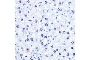 Immunohistochemistry of paraffin-embedded Rat liver using CHD4 antibody (ABIN6127308, ABIN6138512, ABIN6138513 and ABIN6215263) at dilution of 1:100 (40x lens).