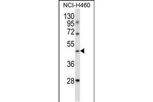 Western blot analysis in NCI-H460 cell line lysates (35ug/lane). (TLE6 anticorps  (N-Term))