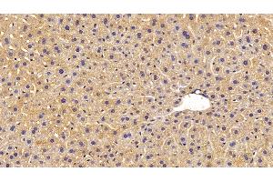 Detection of MASP1 in Mouse Liver Tissue using Polyclonal Antibody to Mannose Associated Serine Protease 1 (MASP1) (MASP1 anticorps  (AA 25-453))