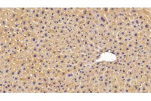 Detection of MASP1 in Mouse Liver Tissue using Polyclonal Antibody to Mannose Associated Serine Protease 1 (MASP1) (MASP1 anticorps  (AA 25-453))