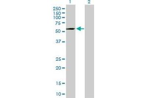 Western Blot analysis of ADAD1 expression in transfected 293T cell line by ADAD1 MaxPab polyclonal antibody. (ADAD1 anticorps  (AA 1-565))