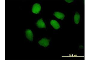 Immunofluorescence of purified MaxPab antibody to ZNF547 on HeLa cell. (ZNF547 anticorps  (AA 1-402))