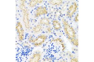 Immunohistochemistry of paraffin-embedded mouse kidney using SRPX antibody at dilution of 1:100 (x40 lens). (SRPX anticorps)