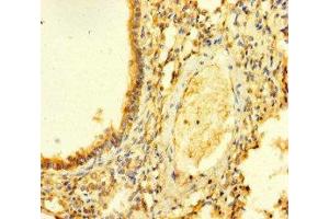Immunohistochemistry of paraffin-embedded human lung tissue using ABIN7153265 at dilution of 1:100 (FGD5 anticorps  (AA 269-539))