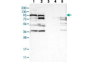 Western blot analysis of Lane 1: RT-4, Lane 2: U-251 MG, Lane 3: Human Plasma, Lane 4: Liver, Lane 5: Tonsil with RRP1B polyclonal antibody  at 1:250-1:500 dilution. (RRP1B anticorps)