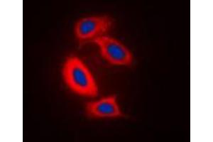 Immunofluorescent analysis of RAB31 staining in Raw264. (RAB31 anticorps  (Center))