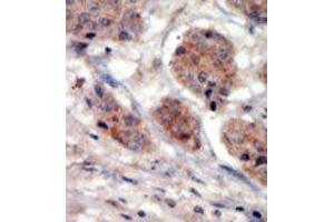 Image no. 2 for anti-Phosphatidylinositol 4-Kinase Type 2 alpha (PI4K2A) (N-Term) antibody (ABIN360472)