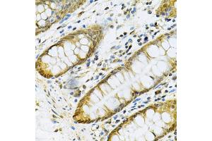 Immunohistochemistry of paraffin-embedded human colon using PGK1 Antibody (ABIN6290734) at dilution of 1:100 (40x lens).
