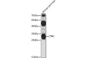 Western blot analysis of extracts of mouse pancreas, using CTRC antibody (ABIN7266396) at 1:1000 dilution. (Elastase 4 anticorps  (AA 30-150))