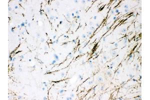 Anti- TH Picoband antibody,IHC(P) IHC(P): Mouse Brain Tissue (TH anticorps  (Middle Region))