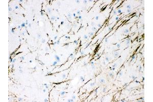 Anti- TH Picoband antibody,IHC(P) IHC(P): Mouse Brain Tissue (Tyrosine Hydroxylase anticorps  (Middle Region))