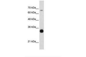 Image no. 3 for anti-THO Complex 3 (THOC3) (AA 151-200) antibody (ABIN203067) (THO Complex 3 anticorps  (AA 151-200))